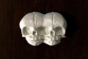 Conjoined Twins Bone Magnet